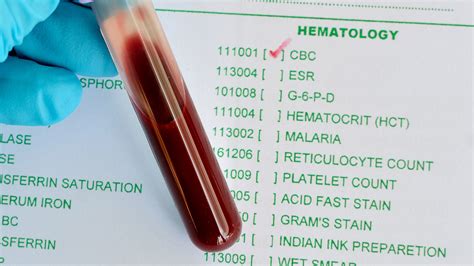 cbc analyzer online|CBC Blood Test (Complete Blood Count) .